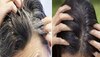 Hair Care Tips: कम उम्र में सफेद बालों से हैं परेशान, तो इन आसान से उपायों से करें इसका निदान