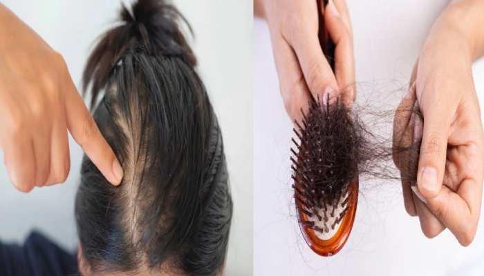 know best way to stop hair fall with hair tips here mkph | बरसात के मौसम में इन चीजों से खुद को रखें दूर, वरना झड़नें लगेंगे बाल | Hindi News, Himachal Pradesh know best way to stop hair fall with hair tips here mkph | बरसात के मौसम में इन चीजों से खुद को रखें दूर, वरना झड़नें लगेंगे बाल | Hindi News, Himachal Pradesh