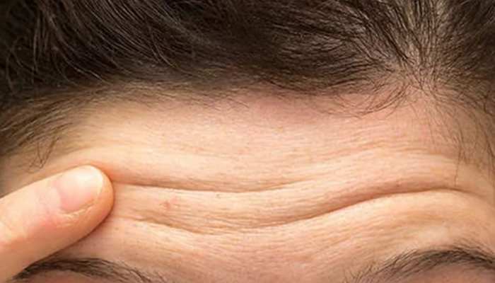 What is the meaning of 3 or 5 lines on forehead in bhavishya ...