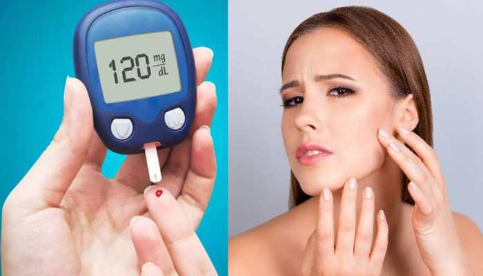 फेस पर दिखने लगें ये वॉर्निंग साइन, तो हो जाएं अलर्ट; कहीं Diabetes तो नहीं?