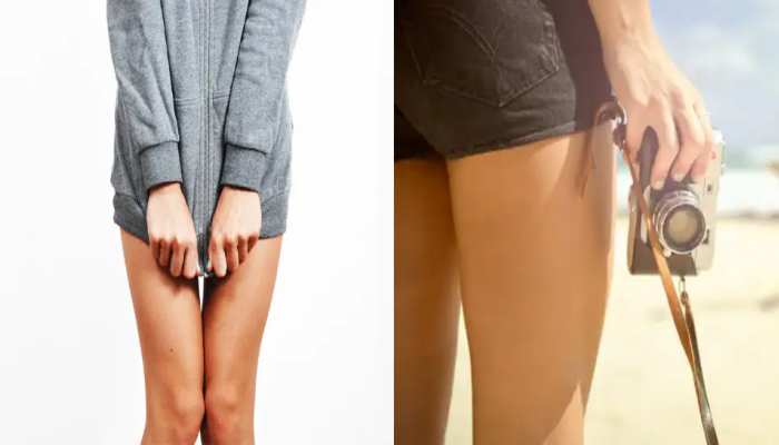 जांघों के कालेपन के कारण Mini Skirt पहनना हुआ मुश्किल? ऐसे दूर करें Darkness