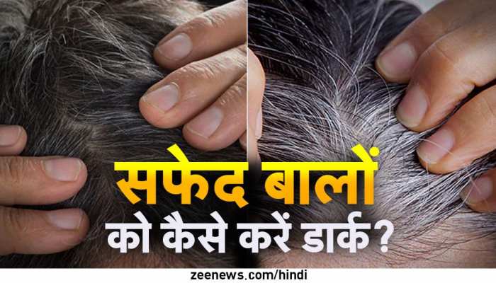 Premature White Hair Problem At Young Age 25 To 30 Years hibiscus gooseberry Onion mehndi Fenugreek | White Hair: यंग एज में बालों में आने लगी सफेदी, इन 5 उपायों से वापस Premature White Hair Problem At Young Age 25 To 30 Years hibiscus gooseberry Onion mehndi Fenugreek | White Hair: यंग एज में बालों में आने लगी सफेदी, इन 5 उपायों से वापस