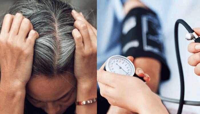 Premature White Hair And High BP Blood Pressure Connection Heart Attack Warning Sign Stroke Disease | White Hair: क्या High BP के मरीजों के बाल जल्दी होते हैं सफेद? जानिए इनके बीच Premature White Hair And High BP Blood Pressure Connection Heart Attack Warning Sign Stroke Disease | White Hair: क्या High BP के मरीजों के बाल जल्दी होते हैं सफेद? जानिए इनके बीच