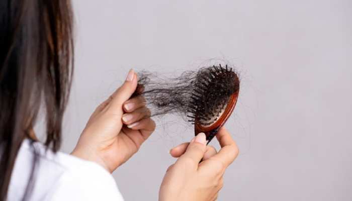 hair fall control tips know home remedies to stop hair fall bal jhadne ka upay samp | Control Hair Fall: गंजेपन से बचने के लिए कंट्रोल करें हेयर फॉल, घर पर अपनाएं hair fall control tips know home remedies to stop hair fall bal jhadne ka upay samp | Control Hair Fall: गंजेपन से बचने के लिए कंट्रोल करें हेयर फॉल, घर पर अपनाएं