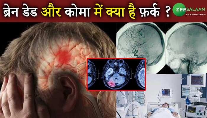 Difference between Brain Dead and Coma: ब्रेन डेड और कोमा में क्या है फ़र्क ?