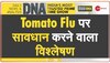 Tomato Flu पर सरकार ने जारी की एडवाइजरी, इन बातों का रखें ध्यान, दूर करें कन्फ्यूजन