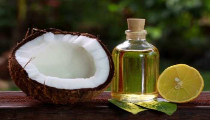 hair care tips apply coconut oil and lemon to get rid of dandruff | Hair Care Tips: डैंड्रफ से छुटकारा पाने के लिए लगाएं नारियल तेल और नींबू,बालों की ये समस्याएं भी