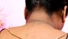 Dark Neck: टैनिंग से गर्दन पड़ गई है काली, तो अपनाएं ये टिप्स; चेहरे की तरह चमकने लगेगी!