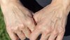 Hand Veins: आखिर क्यों दिखाई देती हैं हाथों की नसें? यहां जान लीजिए इसके पीछे की वजह