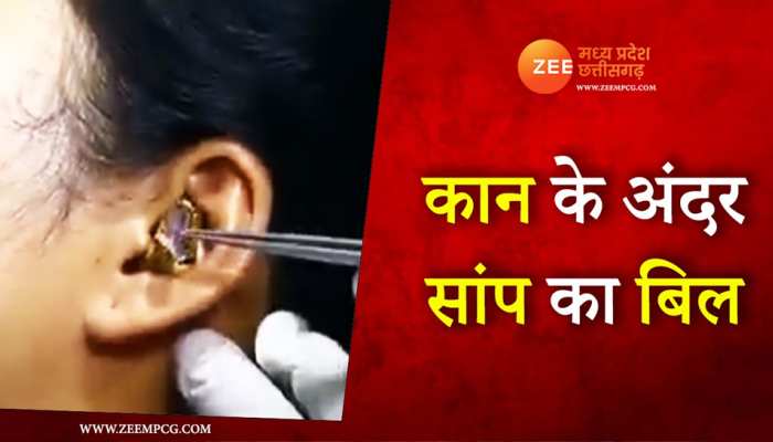 Snake in ear: लड़की के कान को ब‍िल समझकर घुस गया सांप, फ‍िर...