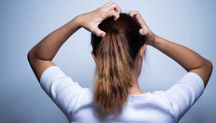 Home Remedies For Lice: How to remove Lice in Hair | Home Remedies For Lice:  सिर से जूं भगाने के लिए बस अपनाएं यह आसान घरेलू उपाय, लीख भी हो जाएंगी साफ |