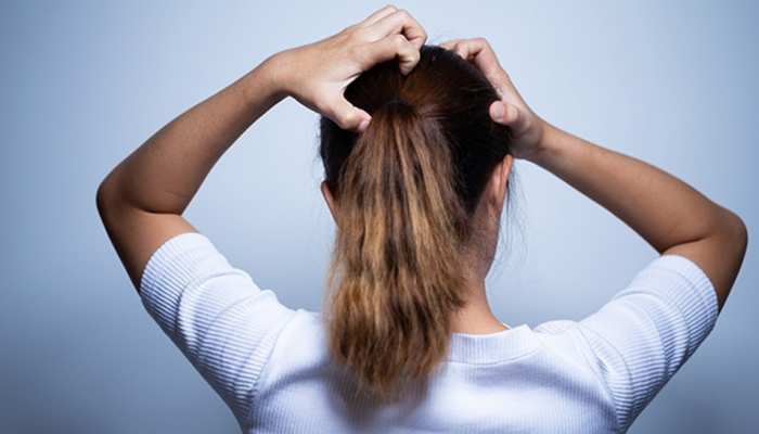 Home Remedies For Lice: How to remove Lice in Hair | Home Remedies For Lice: सिर से जूं भगाने के लिए बस अपनाएं यह आसान घरेलू उपाय, लीख भी हो जाएंगी साफ | Home Remedies For Lice: How to remove Lice in Hair | Home Remedies For Lice: सिर से जूं भगाने के लिए बस अपनाएं यह आसान घरेलू उपाय, लीख भी हो जाएंगी साफ |