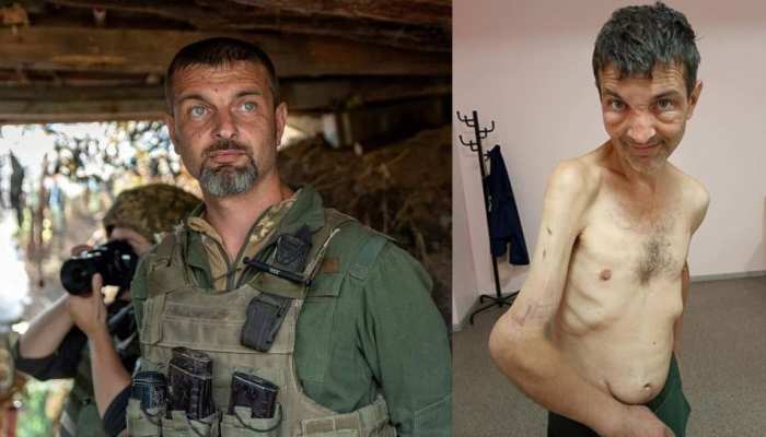 रूस द्वारा पकड़े गए Ukraine के सैनिक की ऐसी हो गई हालत, पहले और बाद की फोटो आई सामने