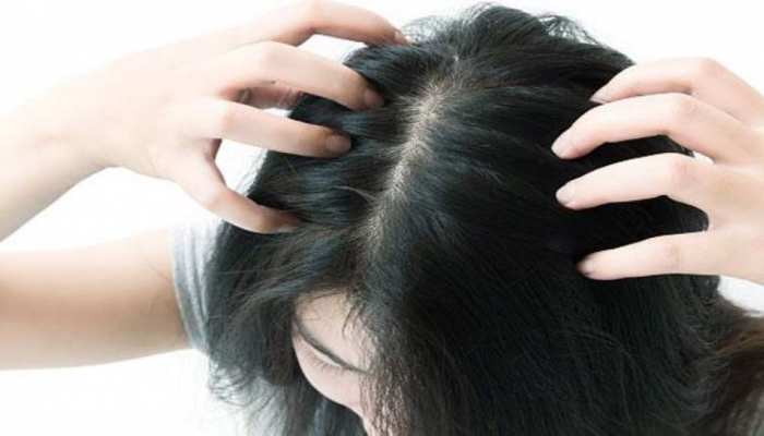 hair care tips get rid of itchy scalp with these home remedies | Hair Care Tips: सिर में खुजली से हैं परेशान? तो इन घरेलू तरीकों से करें दूर | Hindi News, hair care tips get rid of itchy scalp with these home remedies | Hair Care Tips: सिर में खुजली से हैं परेशान? तो इन घरेलू तरीकों से करें दूर | Hindi News,