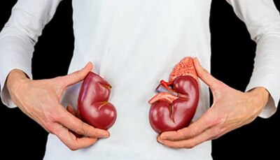 Bad Habits for Kidney health avoid these 5 bad Habits |Kidney Problem:  किडनी के लिए बहुत नुकसानदायक हैं ये 5 आदतें, फिट रहना चाहते हैं तो आज ही कर  लें तौबा