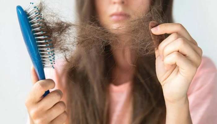 Hairfall Tips: झड़ते बालों का ऐसे रखें ख्याल, अपनाएं ये घरेलू नुस्खे