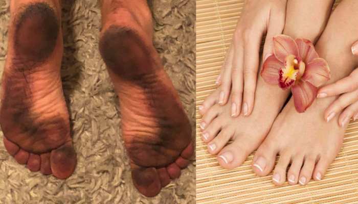 Feet Cleaning: बार-बार जमीन पर रखने से पैर हो गए हैं मैले, इस तरह दूर होगा कालापन
