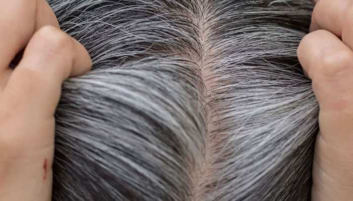 know here how to stop get rid of greying of hair white hair mask solution  treatment home remedies |White Hair Solution: सफेद बालों को काला करने के  लिए नहीं पड़ेगी डाई की