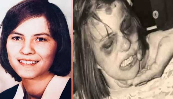 anneliese michel before after