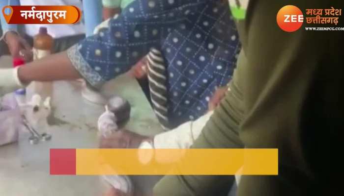 कोबरा सांप के पेट का हुआ ऑपरेशन, देखिए फिर क्या हुआ Video