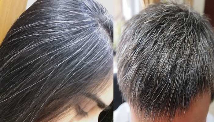 Premature White Hair Home Remedies at 25 to 30 Years age group Curd Onion Juice Curry Leaves Tomato | White Hair Problems: 25 से 30 की उम्र में बाल हो रहे हैं Premature White Hair Home Remedies at 25 to 30 Years age group Curd Onion Juice Curry Leaves Tomato | White Hair Problems: 25 से 30 की उम्र में बाल हो रहे हैं