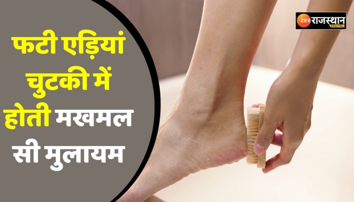 Beauty Tips: सर्दियों में फट रही एड़ियों से मिलेगी राहत, एड़ीयां होगी मखमल सी मुलायम