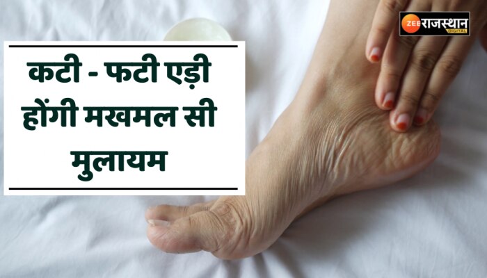 Beauty Tips: मुलायम एड़ियों के लिए लगाएं ये 2 चीजें, कटी- फटी एड़ियां होंगी मखमल सी मुलायम
