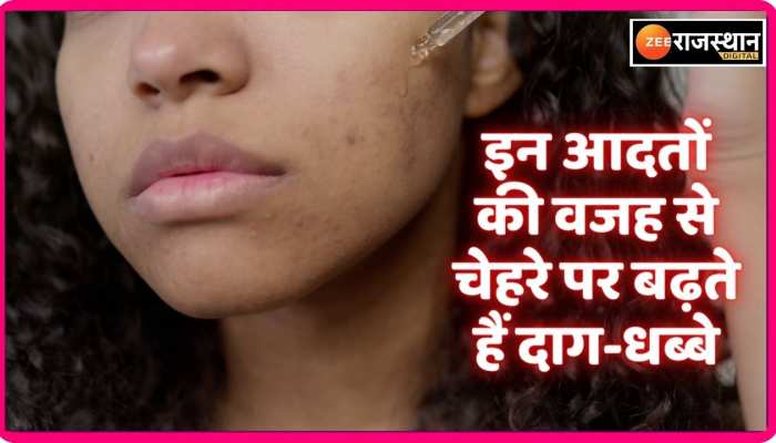 Beauty Tips: चेहरे पर बढ़ रहे दाग - धब्बों के पीछे आपका हाथ, अभी ही बदलें ये आदतें