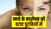 Beauty Tips: माथे पर लगे काले धब्बे को हटा सकती है किचन में रखी ये 4 चीजें