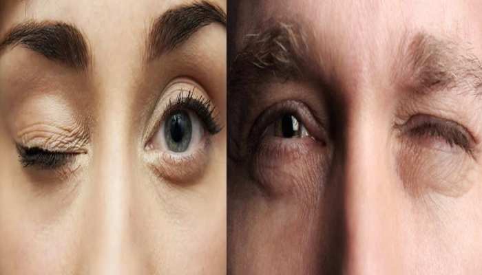 Eye Blinking Meaning for Female and Male in Jyotish Shatra ...