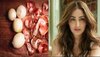 Onion Peel Benefits: प्याज के छिलकों में छिपे हैं सेहत और सौन्दर्य के राज, ऐसे यूज किया तो Yami Gautam की तरह चमकेगी स्किन