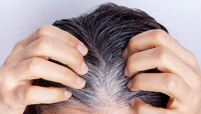 White hair home remedies: follow Shahnaz Husain tips to turn white hair  into black hair naturally | White hair home remedies: सफेद बालों से पाना  चाहते हैं छुटकारा? तो अपनाएं Shahnaz Husain