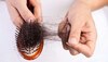 Hair Fall Remedies:  सिर पर घट रहे बालों की वजह से झेलनी पड़ती है शर्मिंदगी? अपना लें ये 5 घरेलू नुस्खे, फिर से आ जाएगी रौनक 