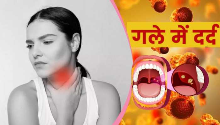 क्या ठंड की वजह से आपके गले में भी है दर्द, Tonsil Cancer के भी हो सकते हैं लक्षण