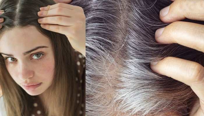 Safed baal kale kaise kare How to Prevent Premature White Hair Tension Smoking Sleeping Oil Massage | White Hair: कम उम्र में सफेद बाल आने से रोक सकते हैं आप, बस करने Safed baal kale kaise kare How to Prevent Premature White Hair Tension Smoking Sleeping Oil Massage | White Hair: कम उम्र में सफेद बाल आने से रोक सकते हैं आप, बस करने