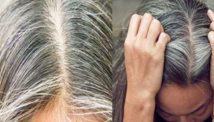 White Hair Home Remedies and Solutions How to make White Hair Black |White Hair Home Remedies: सफेद बालों को घर बैठे प्राकृतिक तरीके से ऐसे कीजिए काला, बड़े काम के हैं ये White Hair Home Remedies and Solutions How to make White Hair Black |White Hair Home Remedies: सफेद बालों को घर बैठे प्राकृतिक तरीके से ऐसे कीजिए काला, बड़े काम के हैं ये