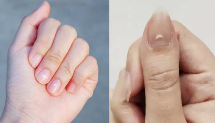 White Spot on Nails: बहुत लकी साबित होता है नाखून पर बना ये छोटा सा निशान-धब्बा! धन-ऐश्वर्य से भर जाता है जीवन | Black and White Spots On Nails meaning lucky signs White Spot on Nails: बहुत लकी साबित होता है नाखून पर बना ये छोटा सा निशान-धब्बा! धन-ऐश्वर्य से भर जाता है जीवन | Black and White Spots On Nails meaning lucky signs