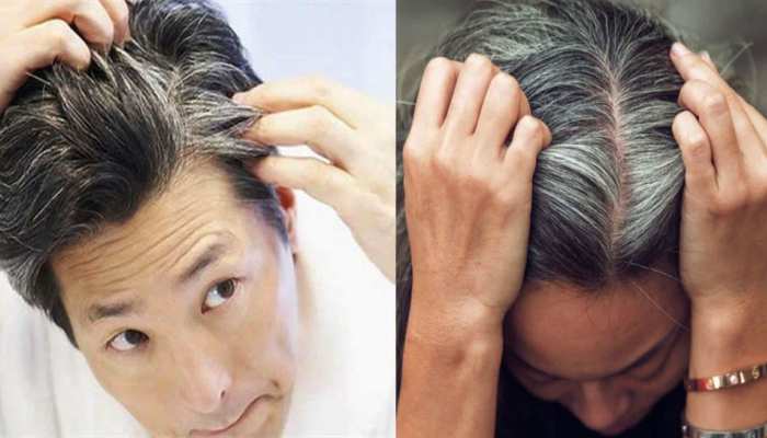 White Hair: How To Make gray hair naturally black, With the Help of these things | सफेद बालों को इन चीजों की मदद से बनाएं Naturally Black, डाई लगाने की नहीं पड़ेगी White Hair: How To Make gray hair naturally black, With the Help of these things | सफेद बालों को इन चीजों की मदद से बनाएं Naturally Black, डाई लगाने की नहीं पड़ेगी