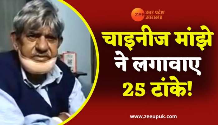 चाइनीज मांझे से घायल हुए 70 साल के बुजुर्ग, चेहरे पर आएं 25 टांके 