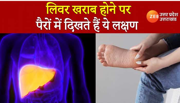 अगर पैरों में दिखें ये लक्षण तो समझ लीजिए खराब हो रहा है आपका लिवर