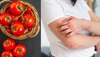 Tomato Side Effects: टमाटर खाने से पहले जान लें नुकसान, बन सकता है इन बीमारियों की वजह