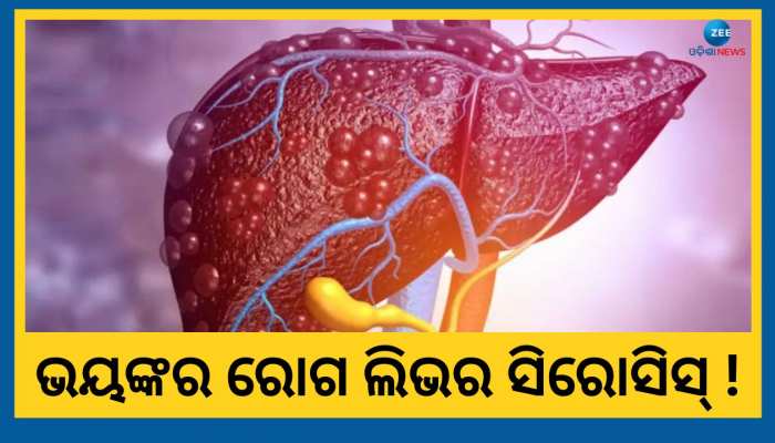 ଜାଣନ୍ତୁ କେତେ ଭୟଙ୍କର ଅଭିନେତା ପିଣ୍ଟୁ ନନ୍ଦଙ୍କୁ ହୋଇଥିବା ରୋଗ, ଏହି ସବୁ ଲକ୍ଷଣ ଦେଖିଲେ ହୁଅନ୍ତୁ ସାବଧାନ !