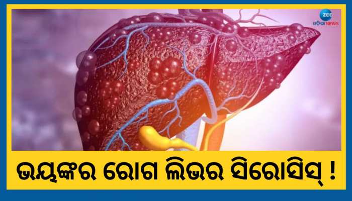  ଜାଣନ୍ତୁ କେତେ ଭୟଙ୍କର ଅଭିନେତା ପିଣ୍ଟୁ ନନ୍ଦଙ୍କୁ ହୋଇଥିବା ରୋଗ, ଏହି ସବୁ ଲକ୍ଷଣ ଦେଖିଲେ ହୁଅନ୍