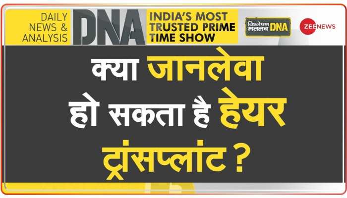 DNA: क्या जानलेवा हो सकता है हेयर ट्रांसप्लांट ?