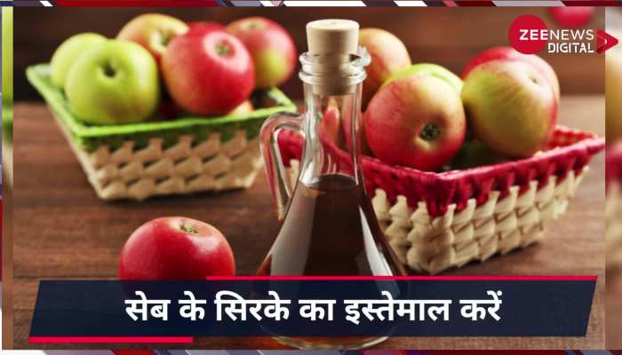 Home Remdies for White Patches: सफेद धब्बों से हो चुके हो परेशान तो करें ये घरेलु उपाए