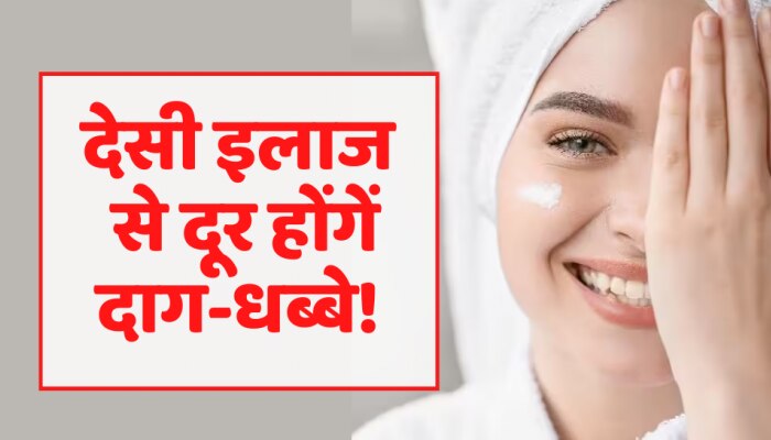 Beauty Tips : Kiara Advani जैसा खिलेगा चेहरा! इस देसी इलाज से छू मंतर हो जाएंगें दाग-धब्बे
