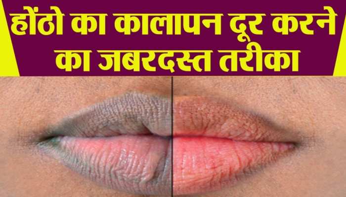 Upper Lip के कालेपन को दूर कर देगी किचन की ये चीज, निखर जाएगी होंठों की रंगत