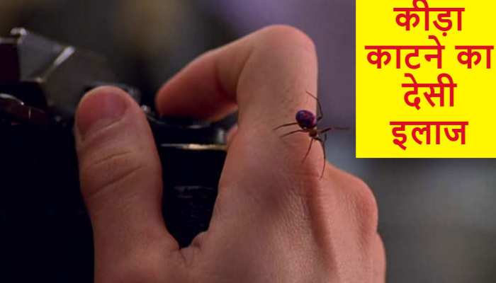 Insect Bites: कीड़े काटने पर बिलकुल भी न लें टेंशन, सूजन और जलन से ऐसे पाएं राहत