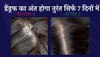 Dandruff Solution: डेंड्रफ की जमी पपड़ी को हफ्तेभर में निकाल बाहर कर देगा ये कच्चा फल, बस ऐसे करें इस्तेमाल