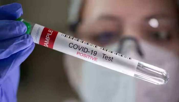 Covid-19:  फिर तेजी से बढ़ने लगे कोरोना मामले, 24 घंटे में इतने लोग हुए संक्रमित